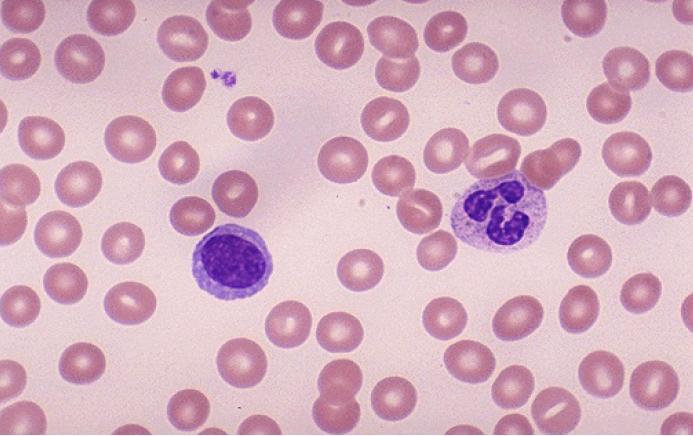 Μικροσκόπηση-Φυσιολογικό αίμα Ροζ κυτταρόπλασμα μα κεντρική ωχρότητα