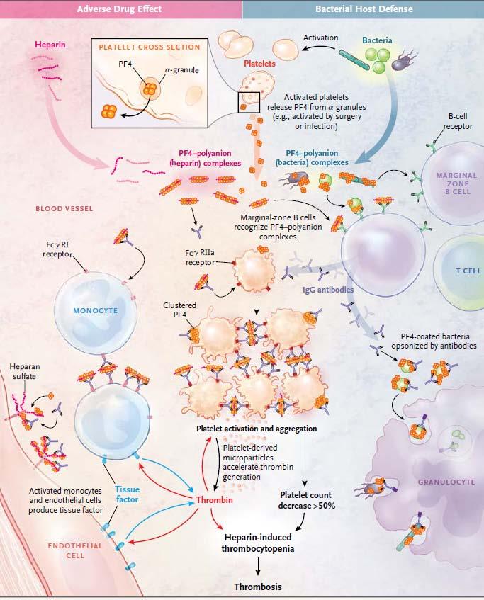 Pathogenesis of Heparin-induced