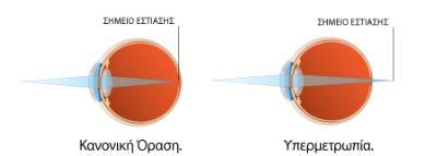 ΚΕΦΑΛΑΙΟ 2: ΑΜΕΤΡΩΠΙΕΣ Σ' έναν οφθαλμό, στον οποίο οι παράλληλες ακτίνες που ξεκινούν από ένα αντικείμενο, σχηματίσουν ένα καθαρό και τέλειο είδωλο πάνω στον αμφιβληστροειδή, χωρίς αυτός να
