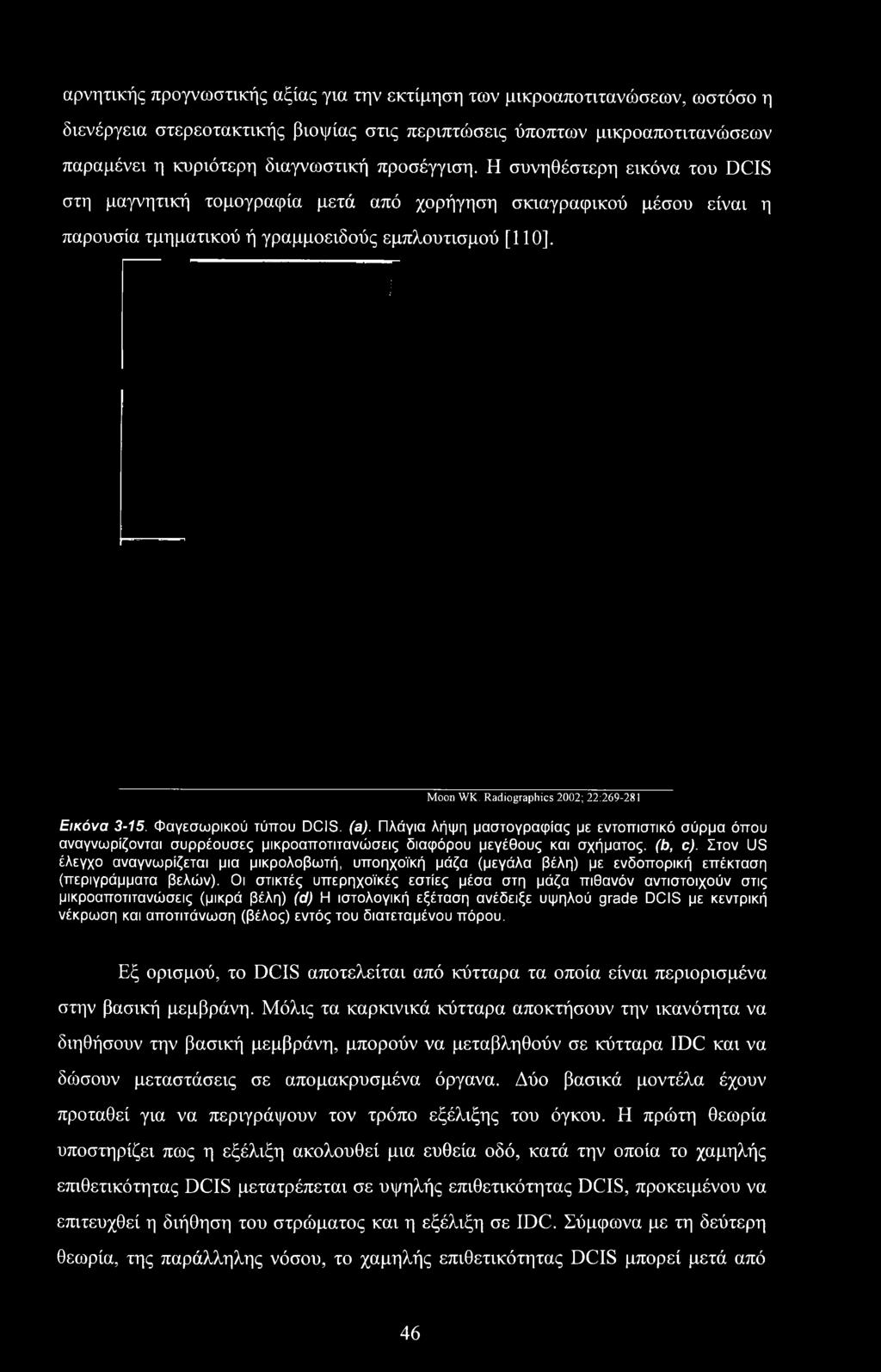 Στον US έλεγχο αναγνωρίζεται μια μικρολοβωτή, υποηχοϊκή μάζα (μεγάλα βέλη) με ενδοπορική επέκταση (περιγράμματα βελών).