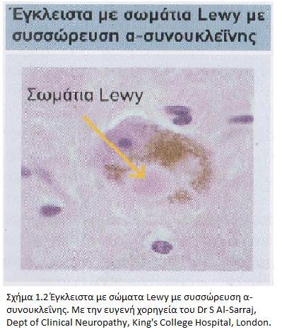 στην οσφρητική δεσμίδα, καθώς και στο περιφερειακό νευρικό σύστημα του εντέρου. Ακολουθεί στο στάδιο 2, έκθεση του ραχιαίου προμήκη και της γέφυρας.