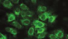 EUROIMMUN Medizinische Labordiagnostika AG Serological diagnosis of Zika virus infections NEW