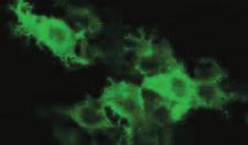 Anti-Zika Virus ELISA/IIFT Anti-Zika Virus ELISA (IgG/IgM) # EI 2668-9601 G/M Highly specific