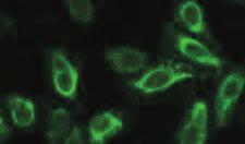 Fully automatable IIFT Arboviral Fever Mosaic 2 (IgG/IgM) # FI 2668-1 G/M Comprehensive