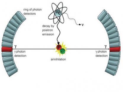 Εσωτερική Ραδιογραφία Positron Emission Tomography (ΡΕΤ) Τομογραφία Εκπομπής