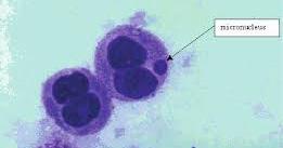 μικροπυρήνας πυρήνας Παρουσιάζονται τυχαία στο κυτταρόπλασμα των κυττάρων, είναι μορφολογικά όμοιοι, αλλά αρκετά μικρότεροι από τους βασικούς πυρήνες και προέρχονται είτε από ολόκληρο το χρωμόσωμα,