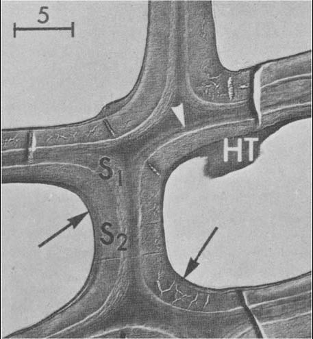 όπως Larix, Picea και Pinus. Τα είδη, όπου οι σπειροειδείς παχύνσεις έχουν βρεθεί και έχουν μελετηθεί περισσότερο, είναι Pseudotsuga menziesii και Taxus baccata (Timell 1978) (Εικόνα 2.8). Εικόνα 2.