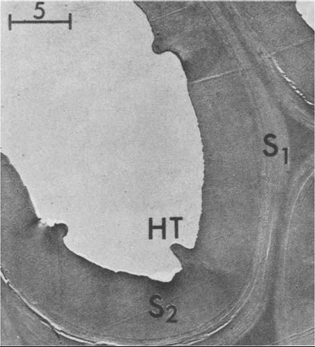 Δεξιά: Εγκάρσια τομή τραχεΐδας θλιψιγενούς ξύλου Taxus baccata. Οι σπειροειδείς παχύνσεις (ΗΤ) βρίσκονται στην S2 στρώση και δεν υπάρχουν ελικοειδείς ραγάδες (Timell 1978).