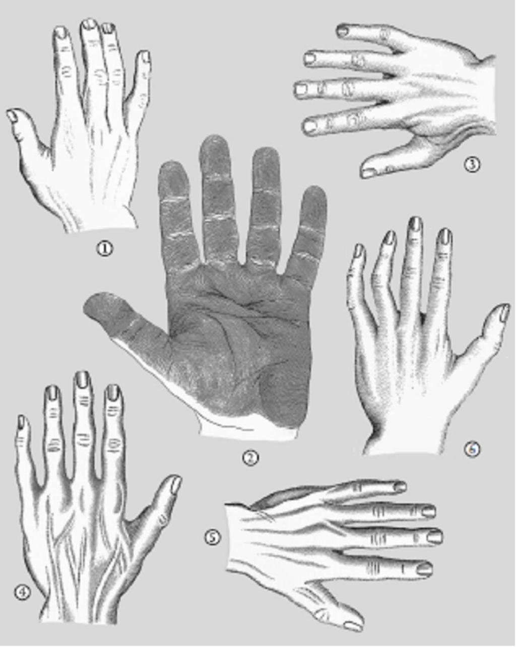 1. Το Φυσιολογικό ή Πρακτικό Χέρι 2. Το Τετράγωνο ή Στοιχειώδες Χέρι 3.