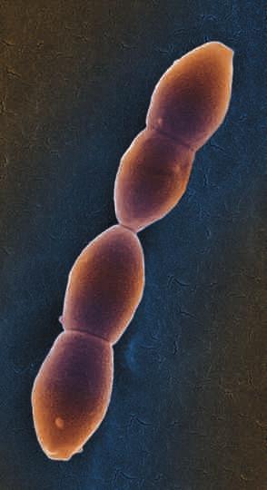 أضواء على األبحاث هذا الشهر Nature Biotechnol. http://doi. org/v9j (2014) نص المشاركن مرحلة مبكرة من تجربة إكلنكة.