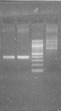 1 2 Μ 3 ~ 400 bp 1000bp 700bp 300bp 22.1.1. Εφαρμογή της μεθόδου για τη γρήγορη ανίχνευση της αναδιάταξης του εξονίου 20 Με την παραπάνω μέθοδο μελετήθηκε η παρουσία των γονιδιακών αναδιατάξεων του