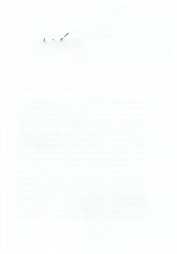18 παραφύσεις, Q βασ ι ιο σπόρου, -\ _ λ *, κυ στ (διού Σγήμα 1. Υμένιο των βασιδιομυκήτων (Φραντζεσκάκης 1990).