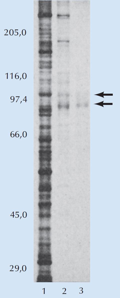 ανακτήθηκαν ύστερα από έναν ή δύο γύρους καθαρισμού με τη μέθοδο της χρωματογραφίας συγγένειας με το DNA (διαδρομές 2 και 3 αντίστοιχα).