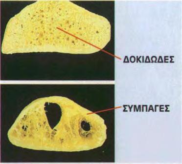 Συμπαγής και Σπογγώδης οστίτης ιστός (πηγή: http://droualb.faculty.mjc.edu και http://demo.openeclass.