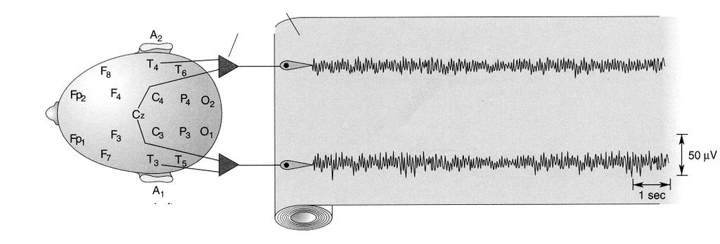 Σχήµα 2 Ενισχυτής Καταγραφή δεξιά αριστερά Η τοποθέτηση των ηλεκτροδίων επιφανείας, που ο αριθµός τους φτάνει τα 20 έως 22 µαζί µε την γείωση, γίνεται σύµφωνα µε το διεθνές σύστηµα 10-20, το οποίο