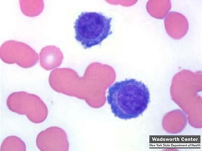πλασματοκύτταρα: σπάνια στο αίμα σε