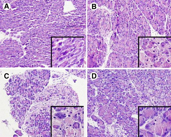 Pancreatita ( clasificare histopatologica) poate fi: - Acuta ( infiltrat neutrofilic) caini si pisici - Cronica ( infiltrat mononuclear) - frecvent