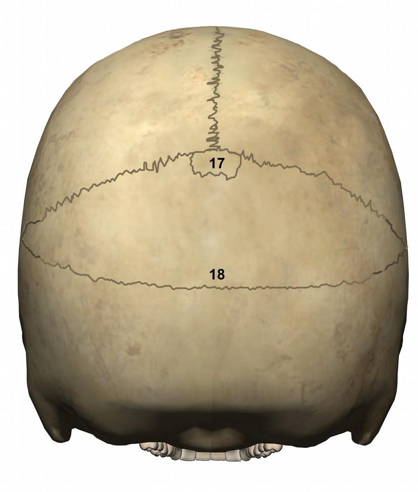 17. Οστάριο στο λάμδα: Οστάριο στη συμβολή της βρεγματικής με τη λαμδοειδή ραφή 18. Οστό των Inca: Τριγωνικό οστάριο στο ινιακό οστό στο ύψος της άνω αυχενικής γραμμής.