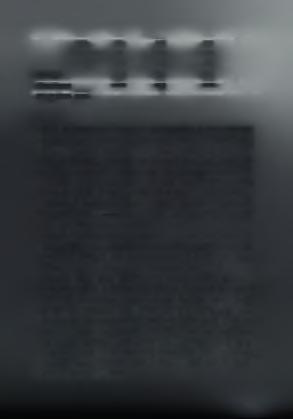 ΗΠΑ 540 260 800 Καναδάς 60 100 160 Άλλες 220 220 440 Αλλες 530 430 960 Παγκόσμια 5500 4050 9500 Πηγή: ΑΙΡΗ, 2005 Όπως έχει ήδη αναφερθεί η Γερμανία και η Αγγλία είναι οι μεγαλύτερες εισαγωγικές χώρες