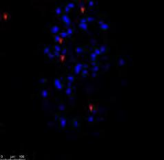 Α B Rabies-EGFP Nkx2-1-Cy3 PV-Cy5 Rabies-EGFP Nkx2-1-Cy3 PV-Cy5 Percentage of Rabies cells 60,00% 50,00% 40,00% 30,00%