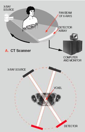 Lesson # Chapter Section: -7 Topics: Laplacian operator Highlights: Definition of Definition of V Special Illustrations: Technology Brief on X-Ray Computed Tomography X-Ray Computed Tomography