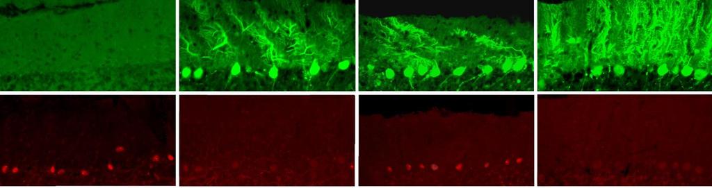 Merge Ataxin GFP ShSCA1.