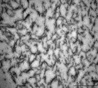 Η απεικόνιση με ηλεκτρονικό μικροσκόπιο των πολύ-εξαμερών της