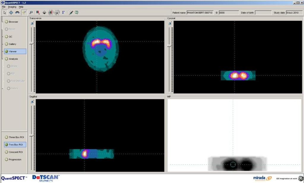 The QuantiSPECT environment PC-based Feed raw data or DICOM