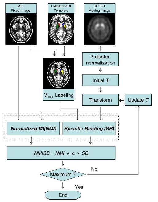 SPM (Statistical Parametric Mapping) Flow chart for