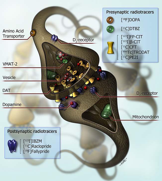 Nuclear medicine imaging radiopharmaceuticals in Parkinson s disease (SPECT και PET) SPECT 123Ι-Ioflupane (DaTSCAN)
