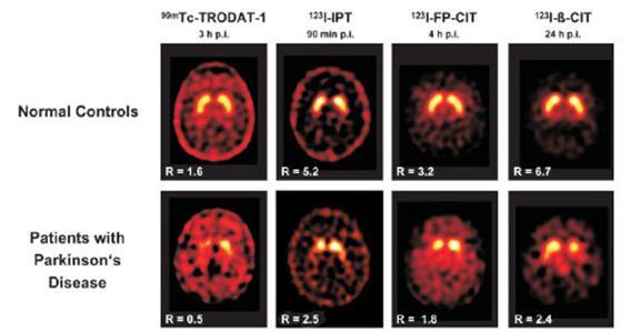 Various radiopharmaceuticals same image Tatsch K.