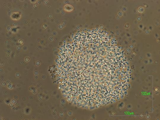 Φώτο: Σεβτσένκο Ινέσσα, Ξυνή Χρυσή Chroococcus limneticus Φώτο: