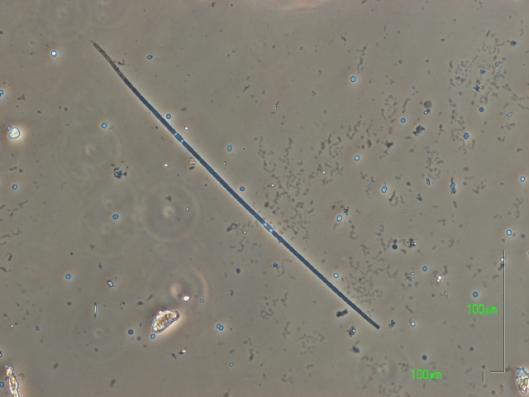 Aphanizomenon flos-aquae. Φώτο: Σεβτσένκο Ινέσσα, Ξυνή Χρυσή Εικόνα 4.