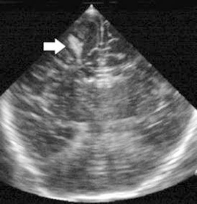 Pediatric Radiology Springer-Verlag 200910.