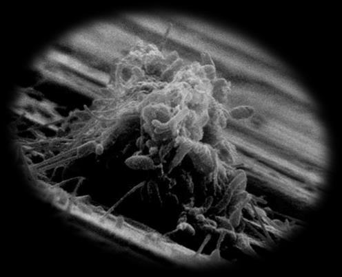2. Βιοϒμϋνια (Biofilms) Κατϊ το πλεύςτο μϋροσ τησ ιςτορύασ τησ Μικροβιολογύασ, οι μικροοργανιςμού ϋχουν πρωτύςτωσ χαρακτηριςτεύ ωσ πλαγκτονικού (planktonic) ότοι ελεϑθερα μεμονωμϋνα και εν αιώρηςη