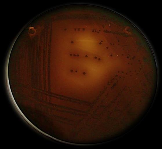 των μαϑρων αποικιών τησ Salmonella spp.
