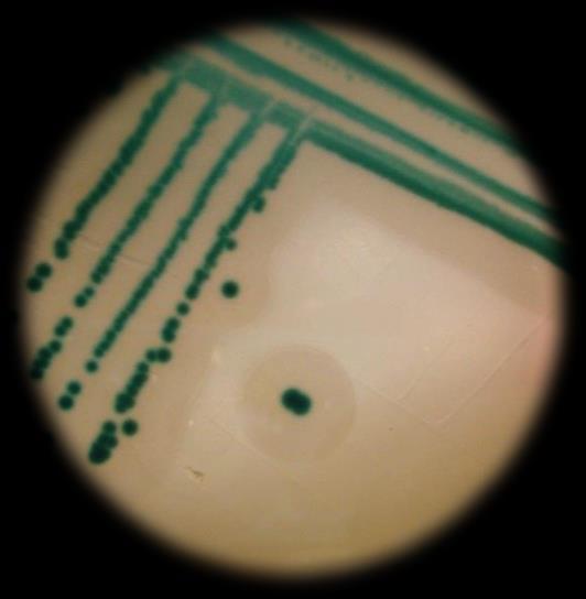Harlequin Listeria Chromogenic Agar ALOA (LABM), ςτο οπούο εύχαν προςτεθεύ τα