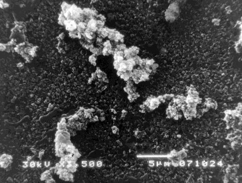 albumin kao protein, koji je veoma važan za preživljavanje,