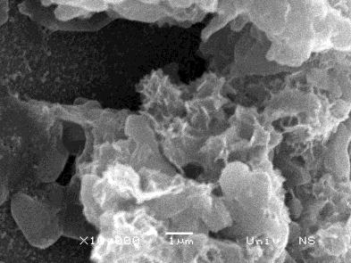 PLA-PLGA, HEMA, hidroksi etil celuloza, modifikovani skrob, alginat i metformin, nanotube funkcionalizovane sa DNK i