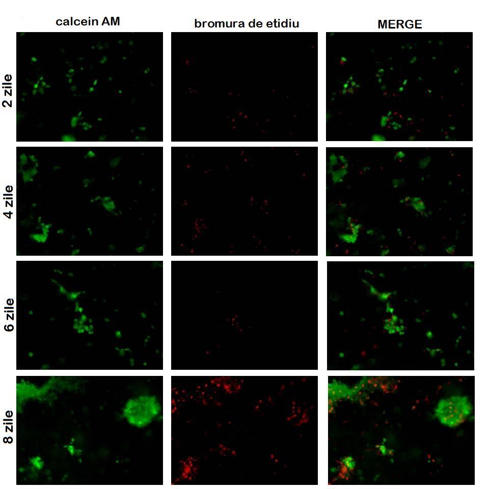 Fig.10- Evidentierea prin microscopie de fluorescenta a celulelor vii si a