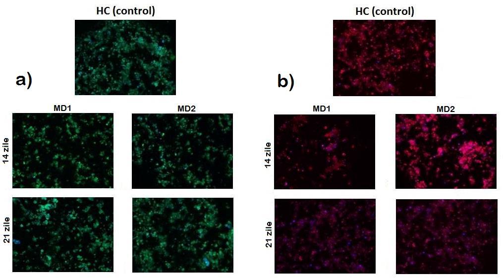 testat (i) diferite retete de inducere a procesului de diferentiere celulara pe cale condrogenica si (ii) diferite tipuri de cultura a celulelor- in sistem bidimensional (2D) si in pelet- in vederea