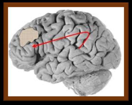 KINHTIKH ΔΙΑΦΛΟΙΙΚΗ AΦΑΣΙΑ (ΤRANS-CORTICAL MOTOR APHASIA) Oμοιότητες με την κινητική αφασία