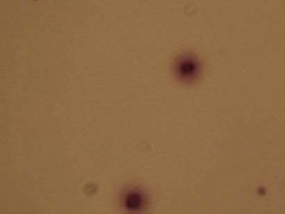 Analiza DNA fragmentacije u spermijima Halosperm test SPERMIJI BEZ DNA FRAGMENTACIJE spemiji s velikom aurom: širina
