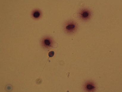 s malom aurom SPERMIJI S FRAGMENTIRANOM DNA spermiji s malom aurom: širina aure je jednaka ili manja od 1/3 manjeg