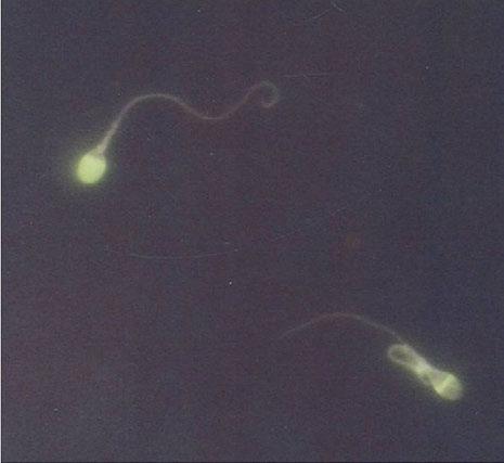 aglutinina konjugiranog s fluorescein