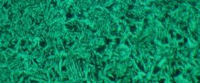 În figurile 7, 8 şi 9 sunt prezentate microstructurile sudurilor celor trei îmbinări compozite nanostructurate (A, B, C). Figura 7.