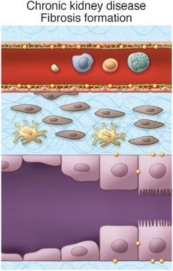 hemoxygenáza reparačné mechanizmy KIM-1