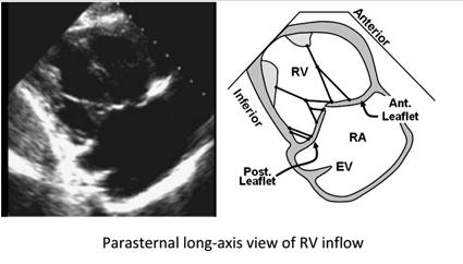 "ivs"επιπέδωση!μέγεθος"rvot!