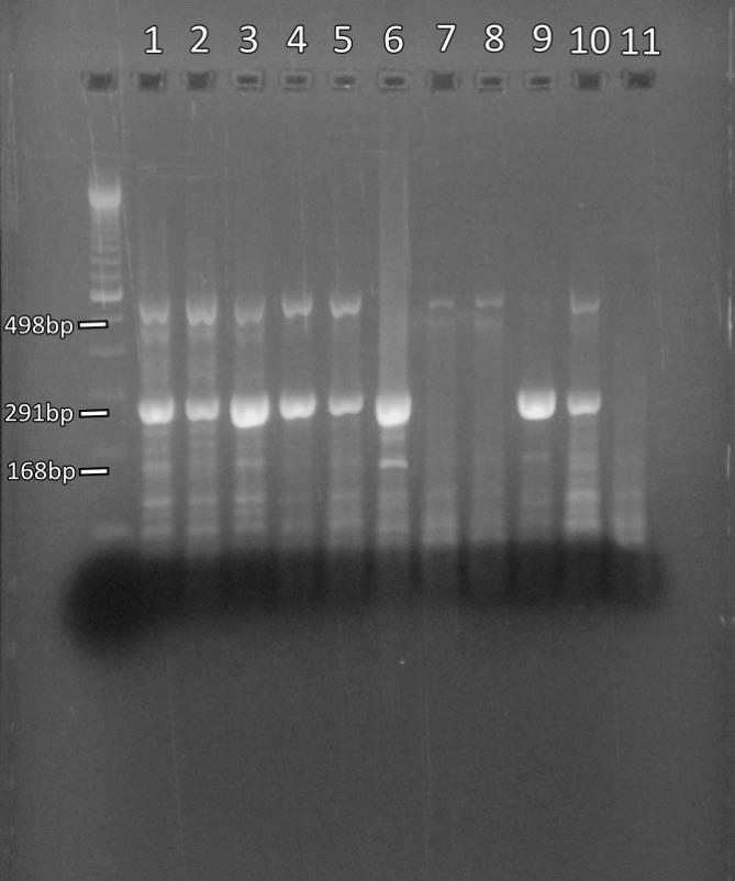 3. ΑΠΟΤΕΛΕΣΜΑΤΑ 3.1 Ταυτοποίηση των κλινικών δειγμάτων Όπως προαναφέρθηκε, τα προϊόντα της Multiplex PCR ηλεκτροφορήθηκαν σε πήκτωμα αγαρόζης.