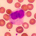 Monociti in makrofagi monociti so največji leukociti, predstavljajo 2-8 % vseh leukocitov v obtoku do 24 ur, nato gredo v periferna tkiva, postanejo makrofagi makrofagi so najbolj